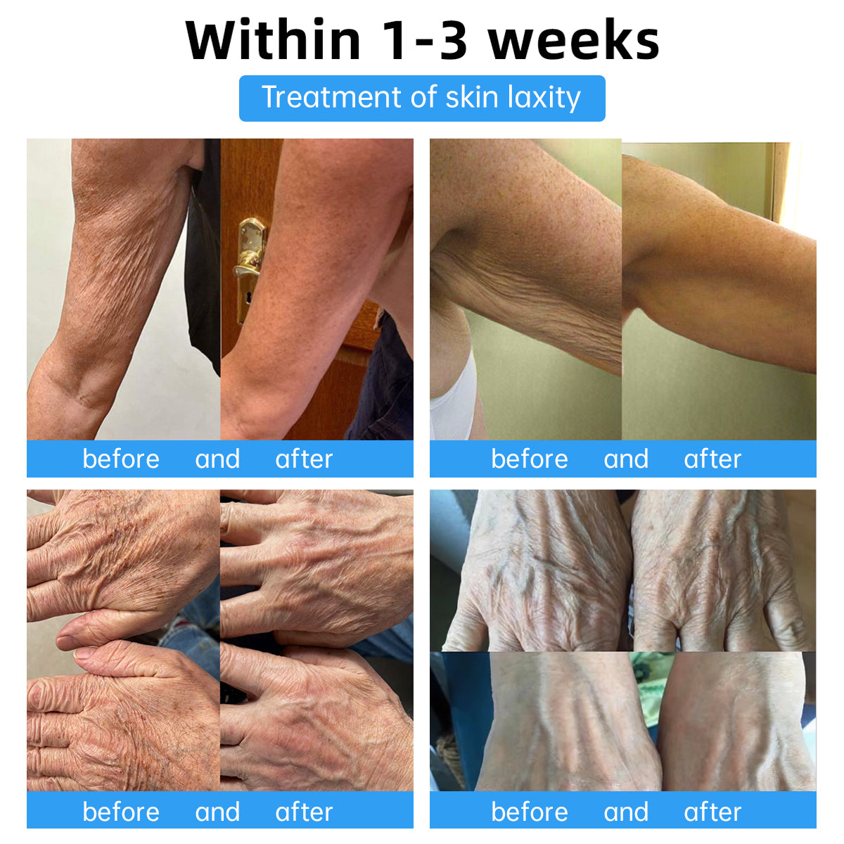 🇺🇸💗 Dr. Smith's Recommended Skin Firming Cream - 74% Off for a Limited Time! 🛍️ Made in US🇺🇸