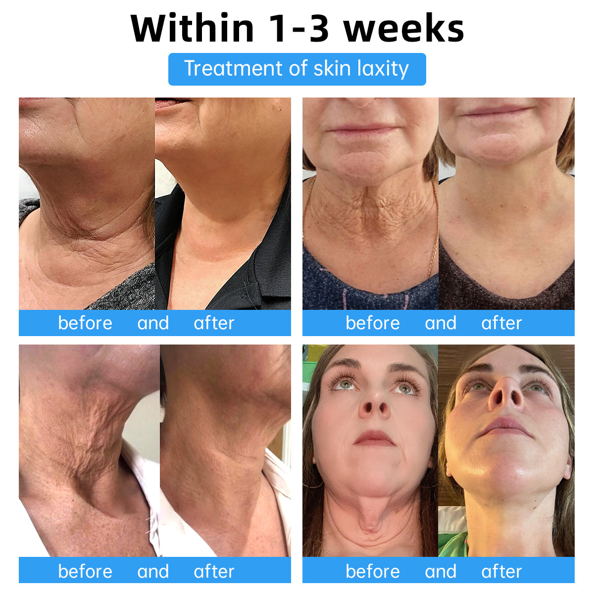 🇺🇸💗 Dr. Smith's Recommended Skin Firming Cream - 74% Off for a Limited Time! 🛍️ Made in US🇺🇸