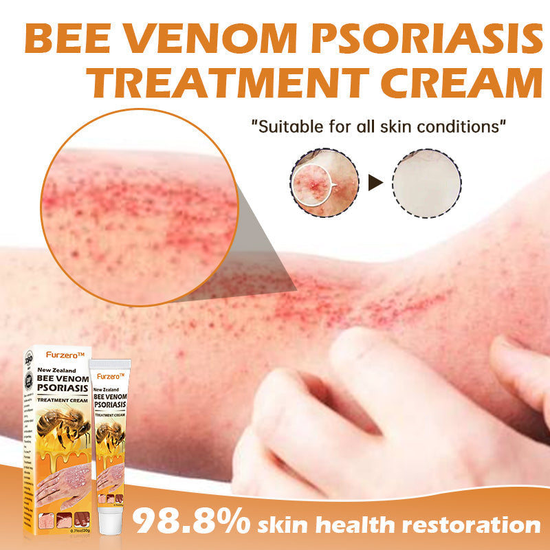 Furzero™ New Zealand Bee Venom Psoriasis Treatment Cream