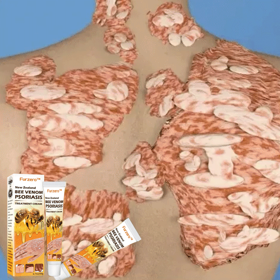 Furzero™ New Zealand Bee Venom Psoriasis Treatment Cream