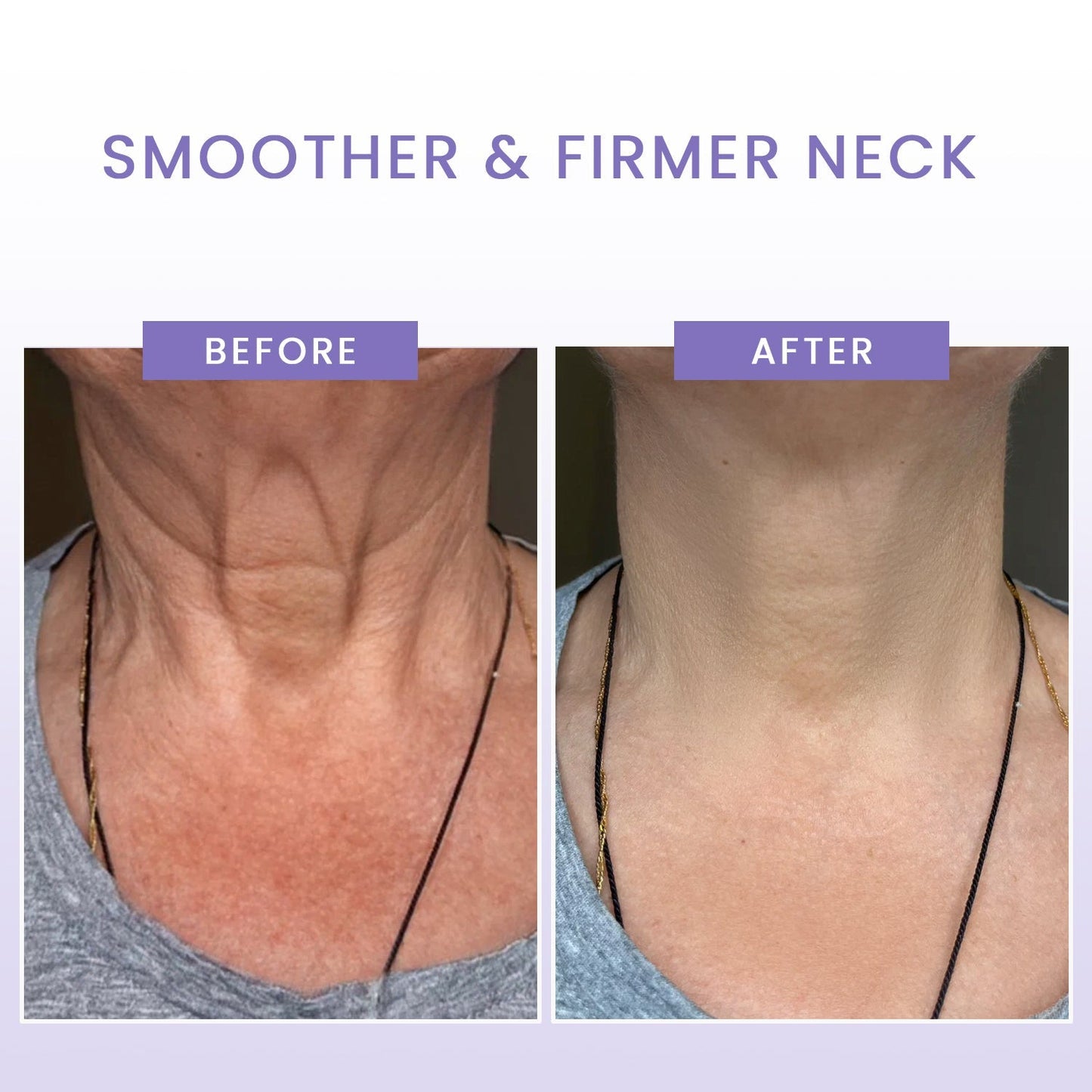 Luhaka™ Wrinkle-Lift Neck Mask