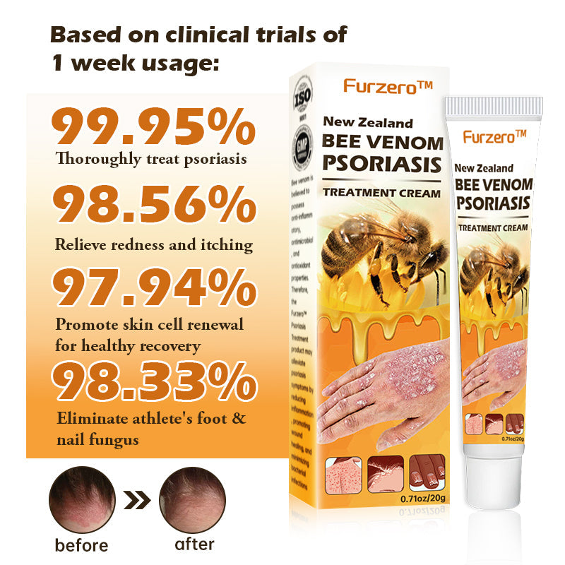 Furzero™ New Zealand Bee Venom Psoriasis Treatment Cream