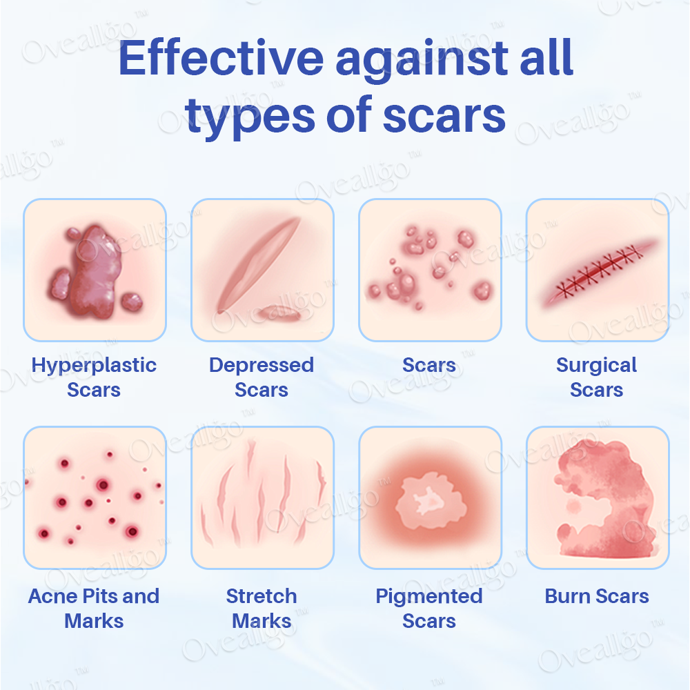 Oveallgo™ Silicone Anti-Scar Cream ✨