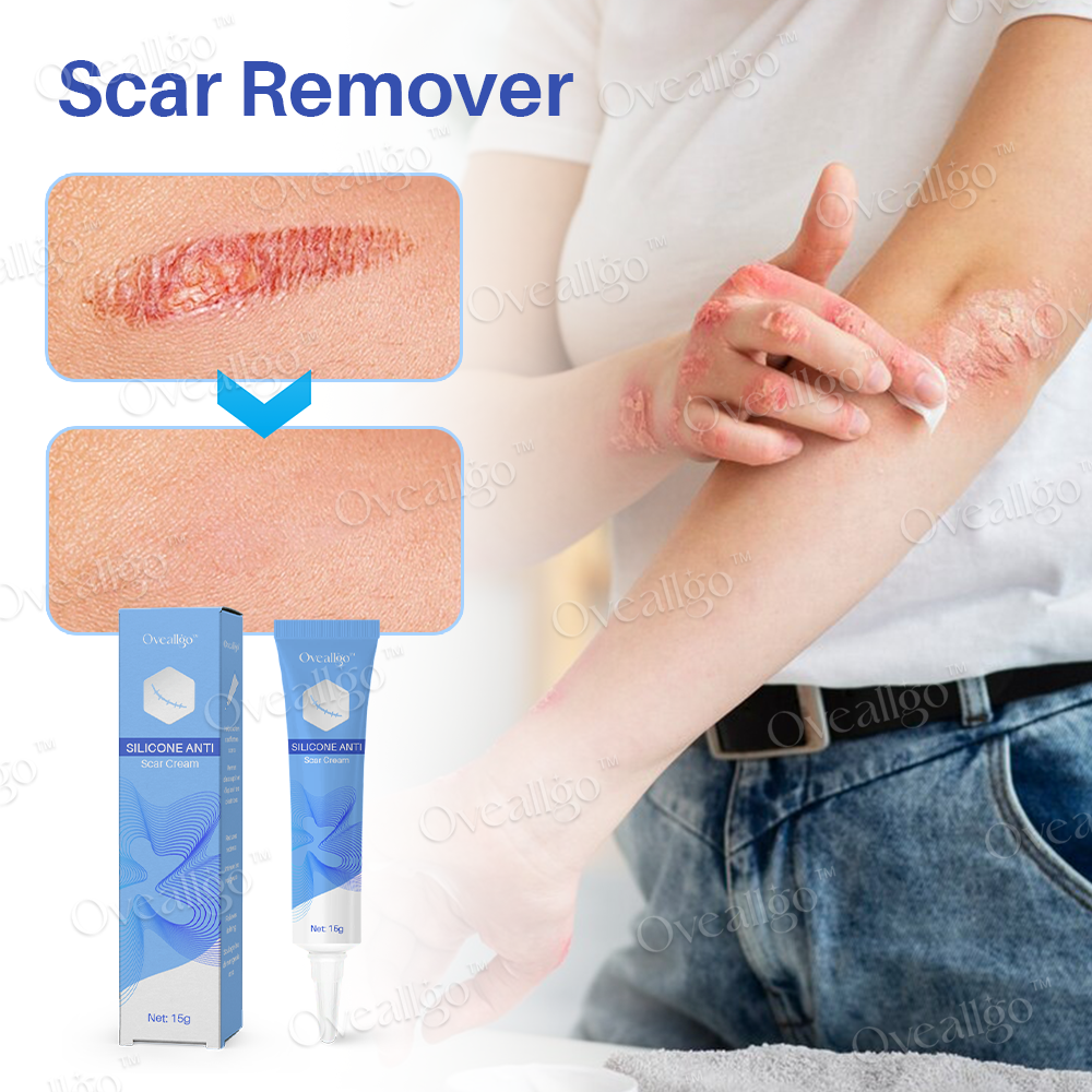 Oveallgo™ Silicone Anti-Scar Cream ✨
