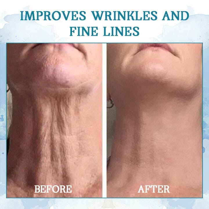 KISSHI™ LuxeLift Skin Firming Youth Butter 🏆
