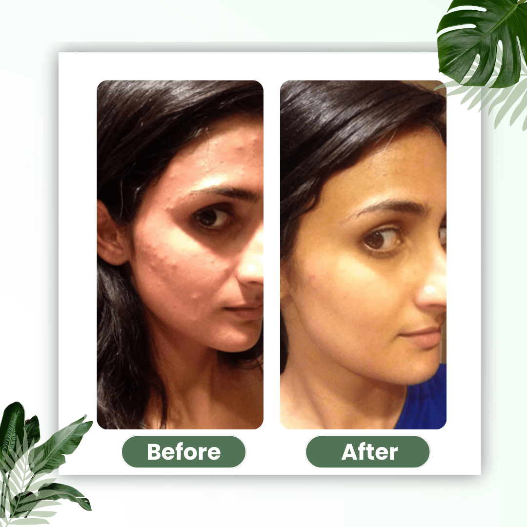 LUHAKA® Green Tea Deep Cleanse Mask Stick ACE