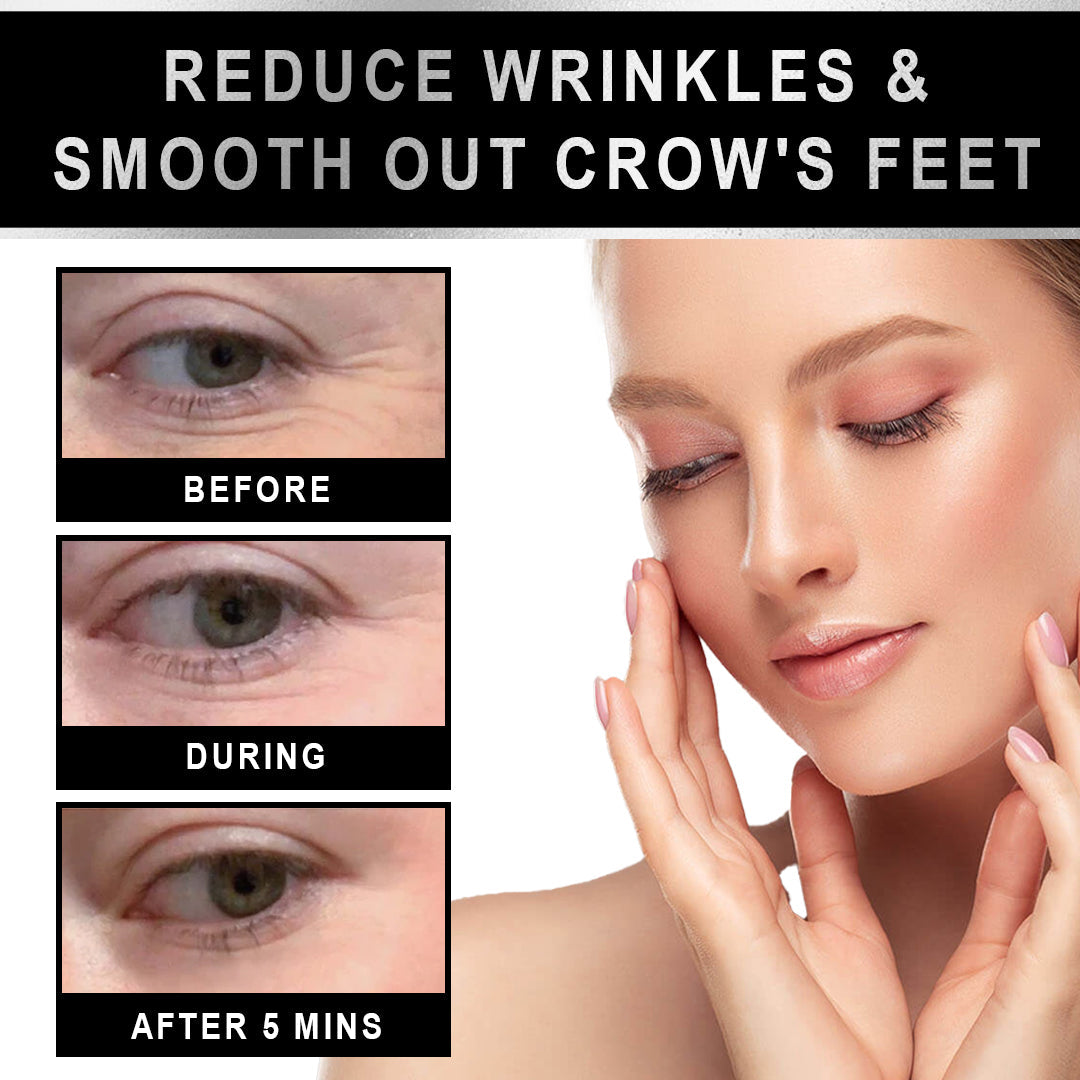 KISSHI™ Clinical SkinCare Instant Eye Tightener 🌟