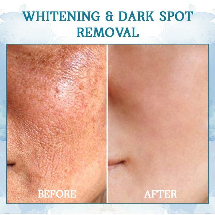 KISSHI™ LuxeLift Skin Firming Youth Butter 🏆