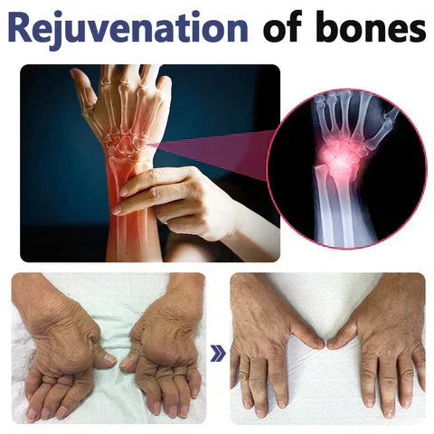 🥇Seurico™ Joint & Bone Pain Foam Spray (Made in AU)