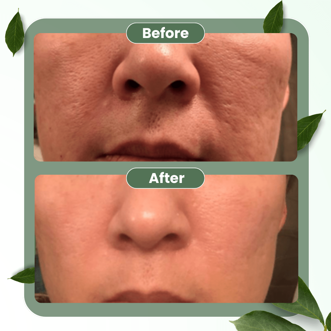 LUHAKA® Green Tea Deep Cleanse Mask Stick ACE