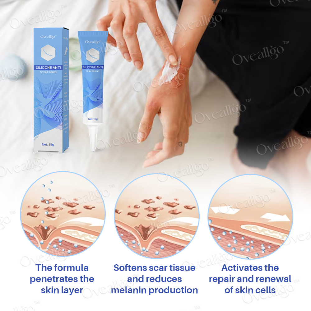 Oveallgo™ Silicone Anti-Scar Cream ✨