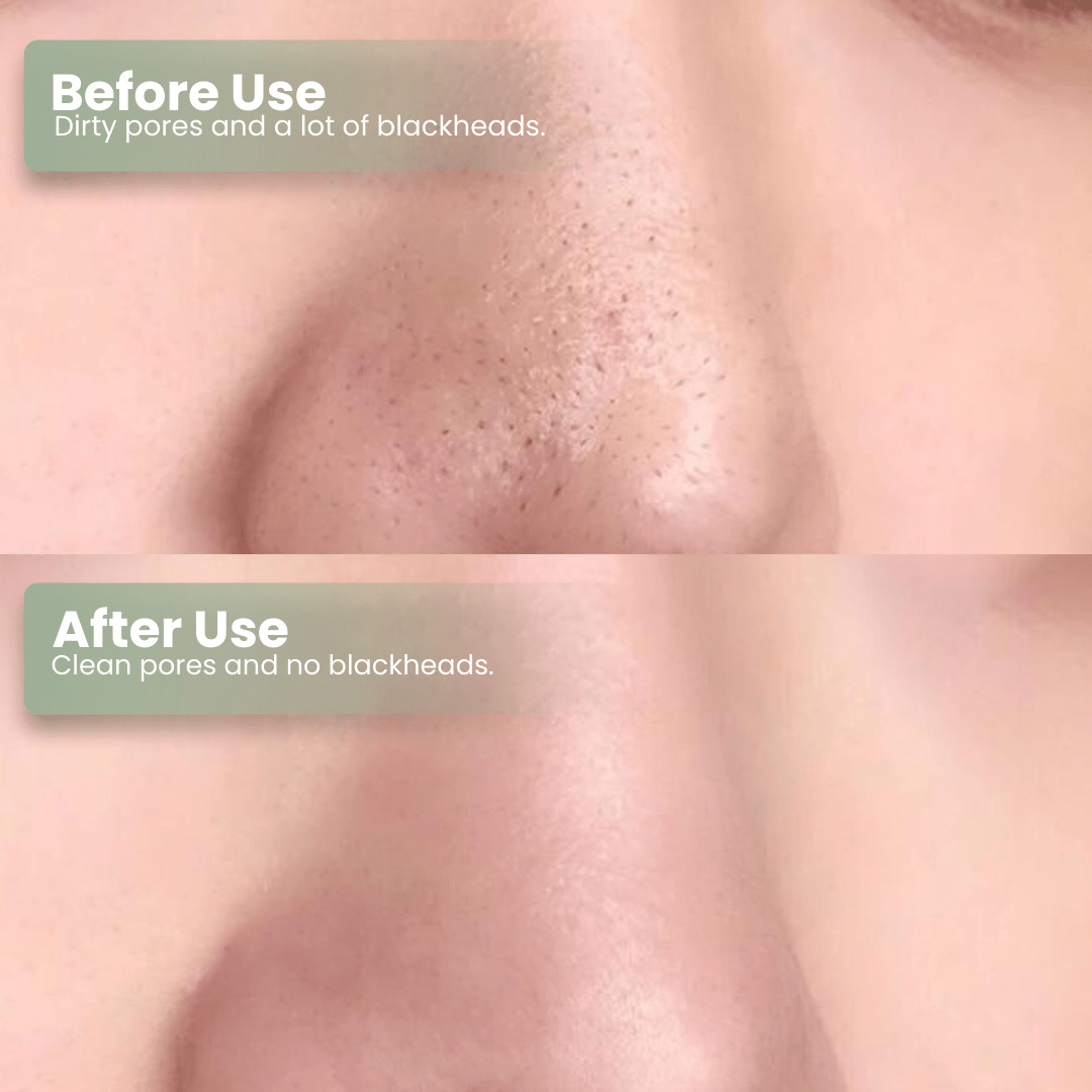 LUHAKA® Green Tea Deep Cleanse Mask Stick ACE