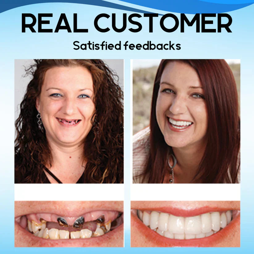 🇦🇺Furzero™ Silicone Reline Denture Set(Made in AU) 🌟
