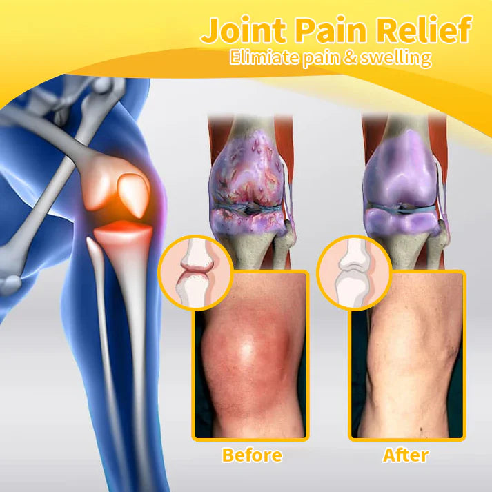 us🌟Flysmus™ Bee-Venom Pain-Relief Bone Healing Cream(Specially for older adults & AOA recommends)💥💥
