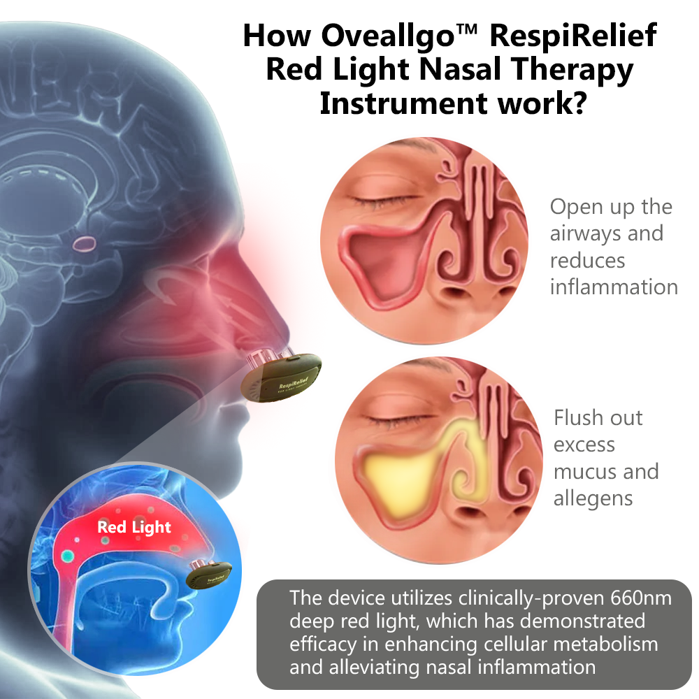 Oveallgo™ RespiRelief Red Light Nasal Therapy Instrument 🔥