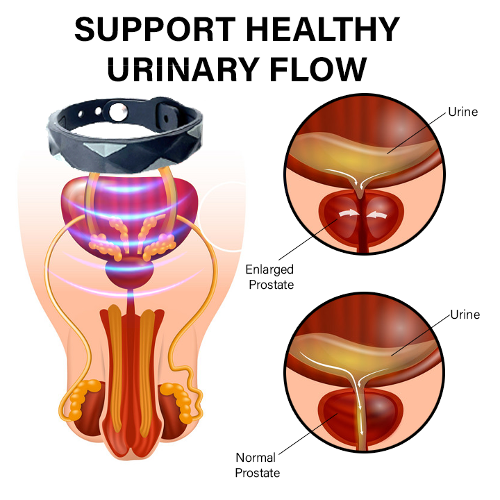 Oveallgo™ RedUp-Iontherapie Prostate Relief Band 💥