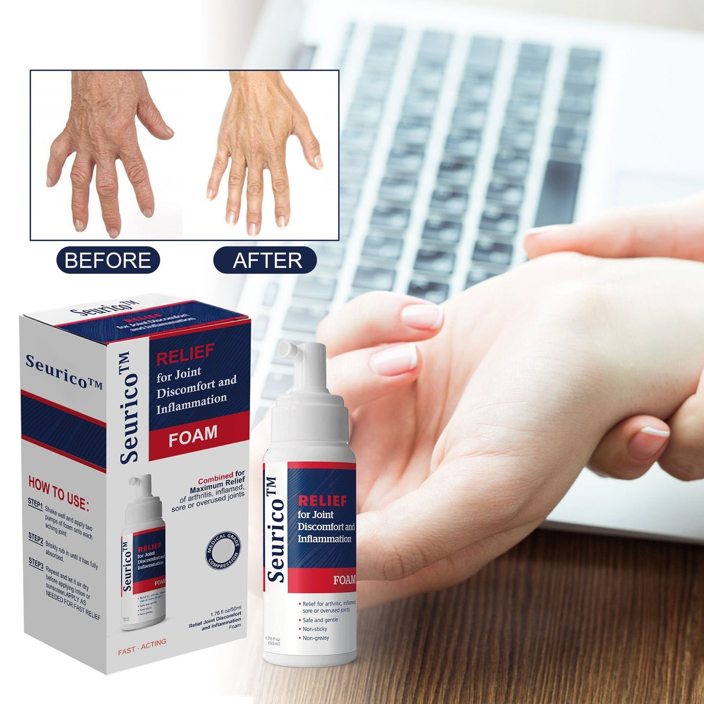 🥇Seurico™ Joint & Bone Pain Foam Spray (Made in AU)