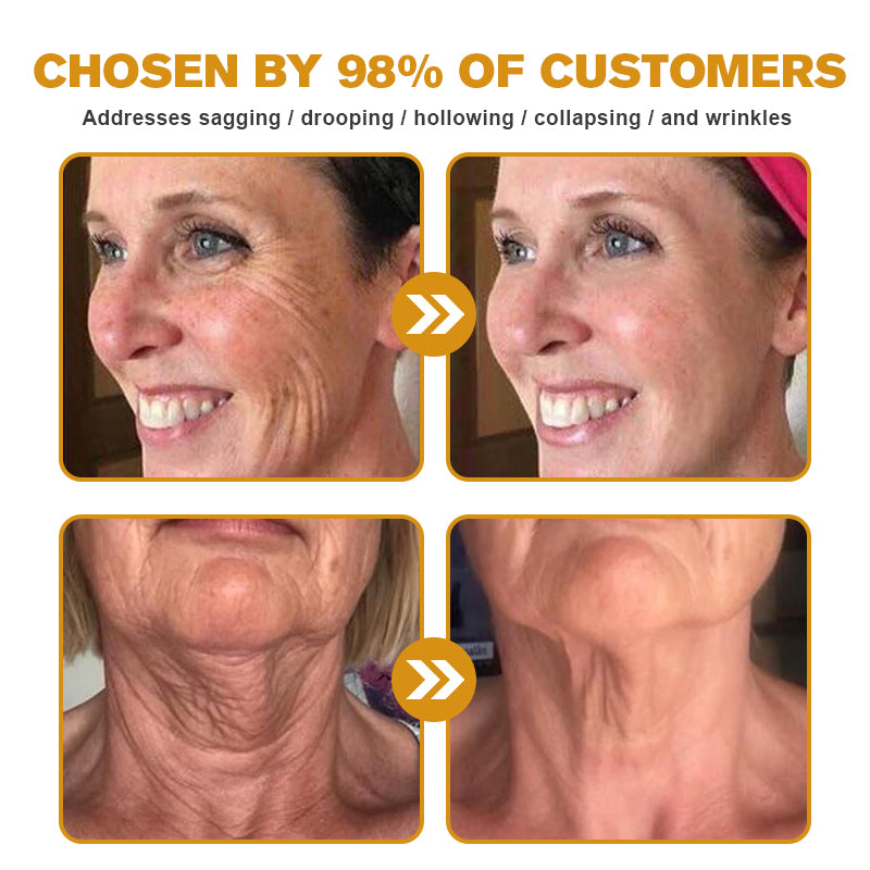 🩸(🪴Made and Shipped from Australia✅) Furzero™ Botox Bee Venom Wrinkle Removal Cream- LAST DAY 70% OFF
