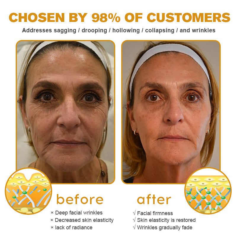 🩸(🪴Made and Shipped from Australia✅) Furzero™ Botox Bee Venom Wrinkle Removal Cream- LAST DAY 70% OFF