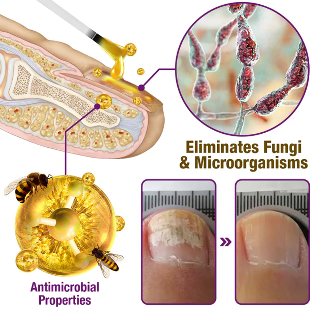 flysmus™ FungiFree Bee Venom Nail Treatment Serum