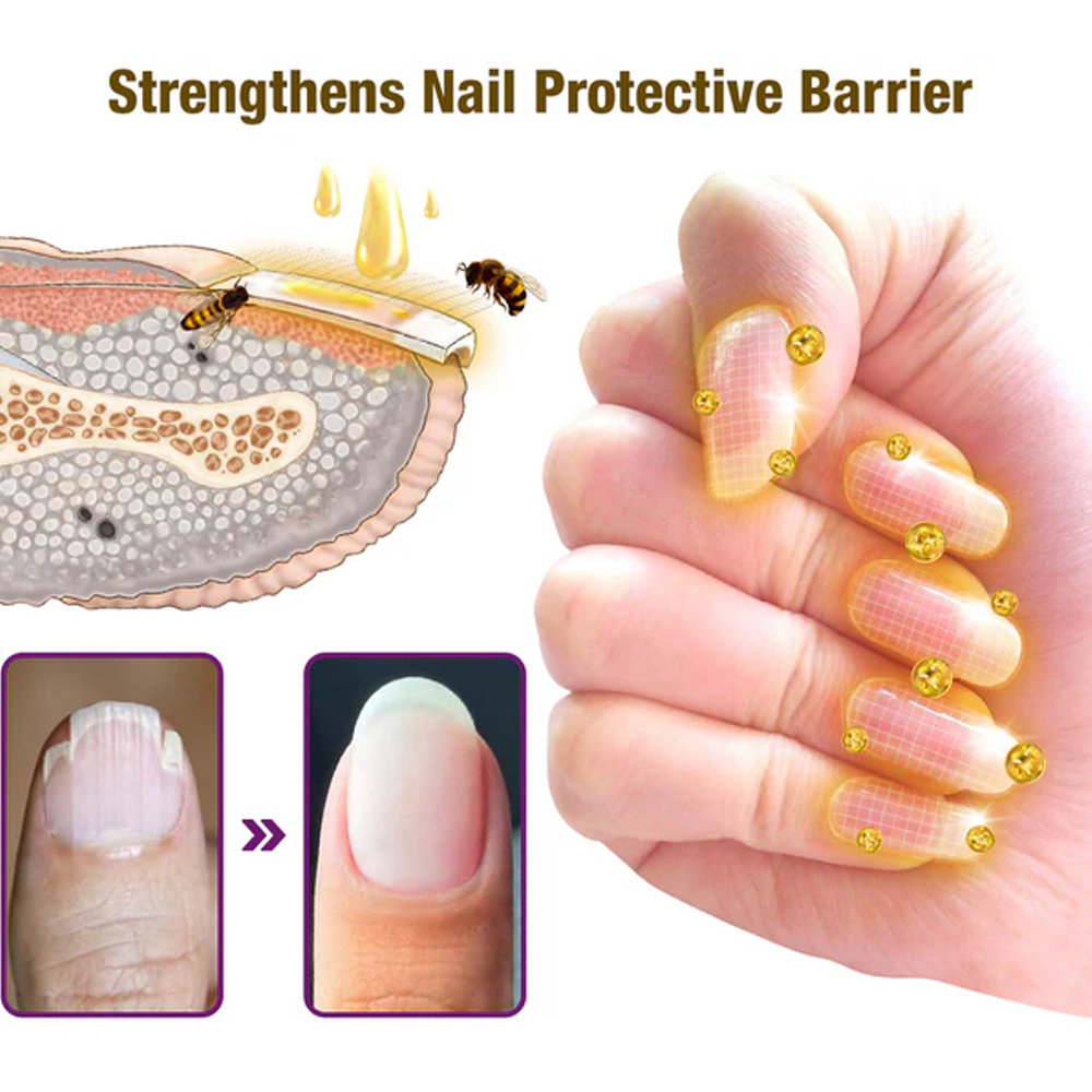 flysmus™ FungiFree Bee Venom Nail Treatment Serum
