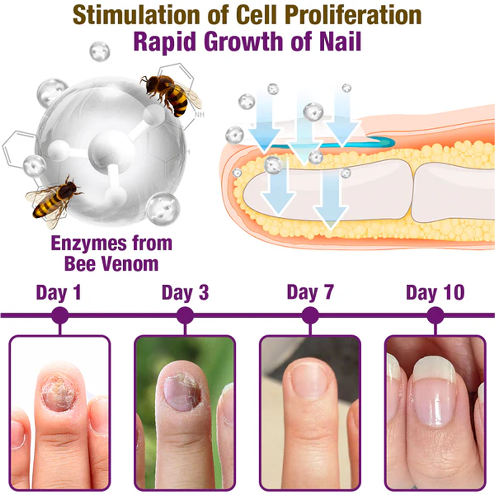 flysmus™ FungiFree Bee Venom Nail Treatment Serum
