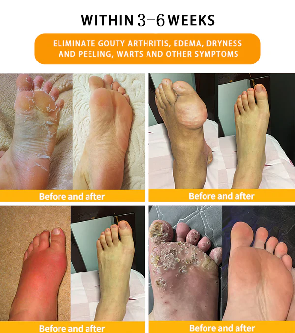 KISSHI™ 30-Herb Slimming & Detox Foot Bath Beads-🦵👩⚕️(LANA Certification, Lymphatic Association of America)