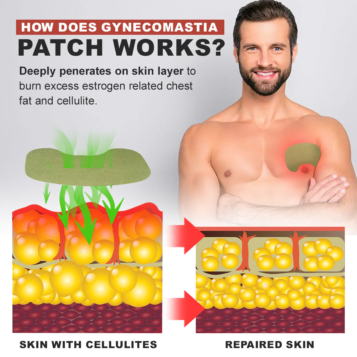 Luhaka™ Gynecomastia Cellulite Melting Patch 🌟Special Offer🌟