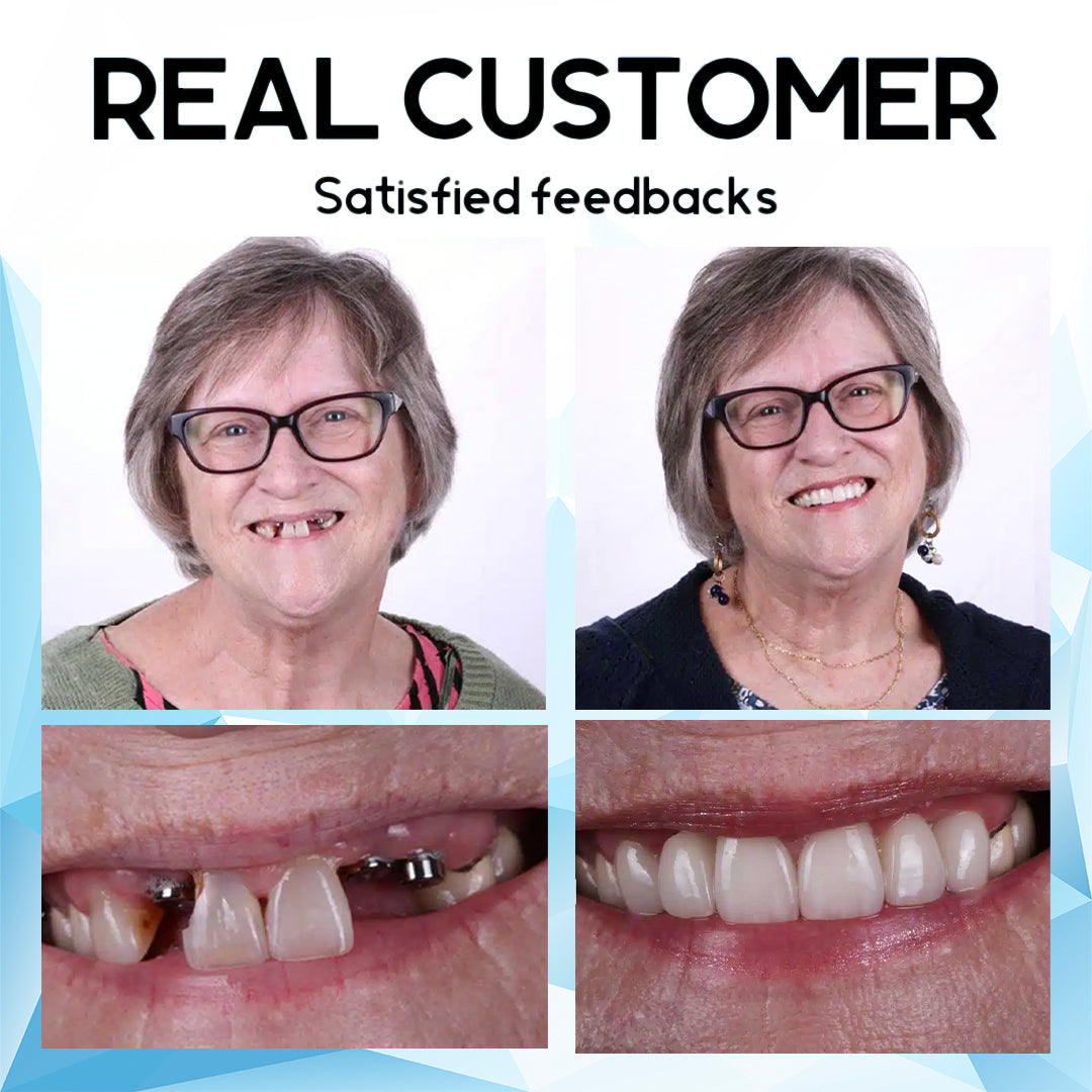 Oveallgo™ Silicone Reline Denture Set🦷  (Made in AU)