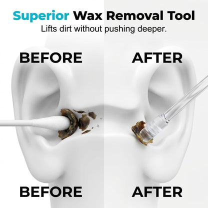 🥳2026 HOT SALE🥳💞50K+ SOLD!🧏‍♂️🌿 50% OFF! Reusable Earwax Remover – Soft adhesive tip. no cotton mess. Simple & gentle for seniors. Keep ears clean & comfortable. 🤲💚