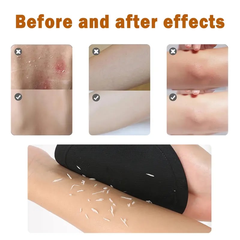 Say Goodbye to Rough, Dull Skin with This Gentle Soft Rubber Shower Scrubber Set