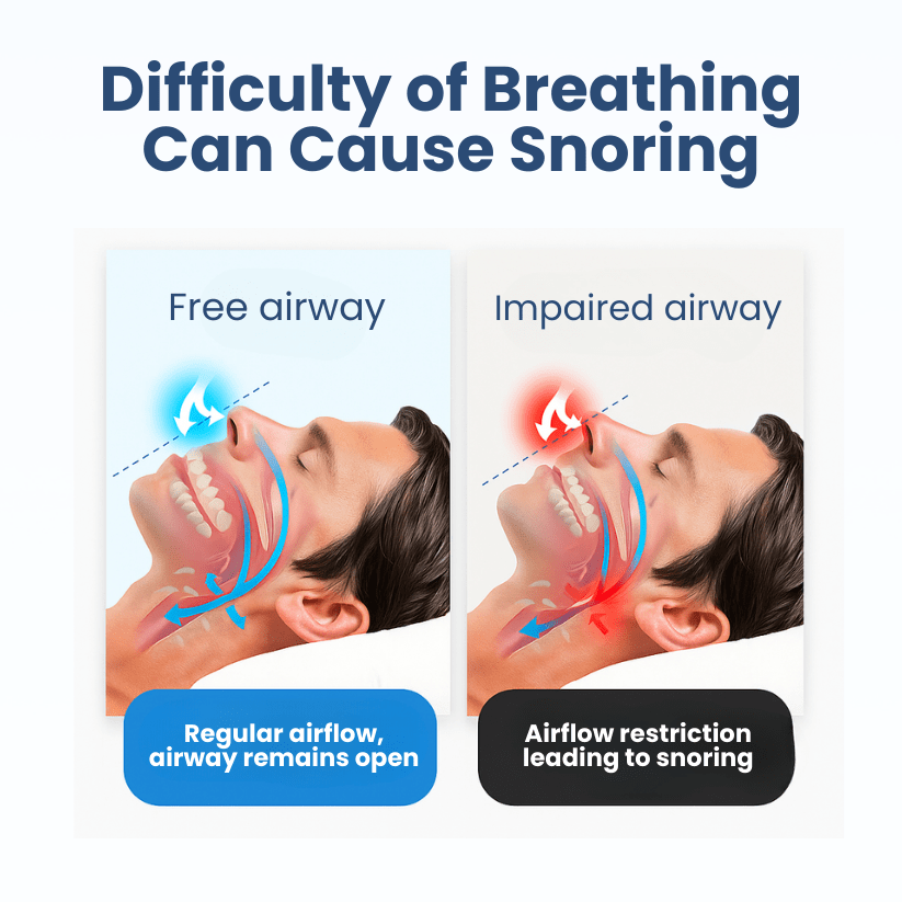 Lyyeto® Snoreless Nasal Breather ACE