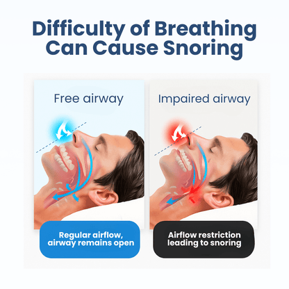 Lyyeto® Snoreless Nasal Breather ACE