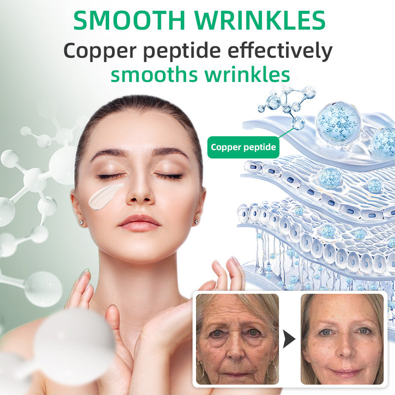 Flysmus™ Wrinkle Removel Cream,Address Crepe & Sagging(🔥50% Off for a Limited Time!)