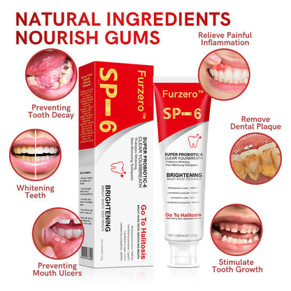 Furzero™ Aussie SP-6 Probiotic Ultra Whitening Toothpaste🦷👨‍⚕️Recommendation(✅ADC-CERTIFIED)