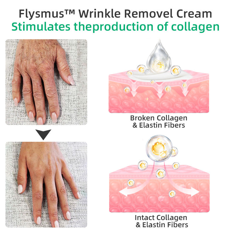 Flysmus™ Wrinkle Removel Cream,Address Crepe & Sagging(🔥50% Off for a Limited Time!)