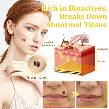 ✅flysmus™ Bee Venom Treatment Cream🐝: Treat Eczema, Psoriasis, Acne, Rosacea, Fungal Infections, Warts