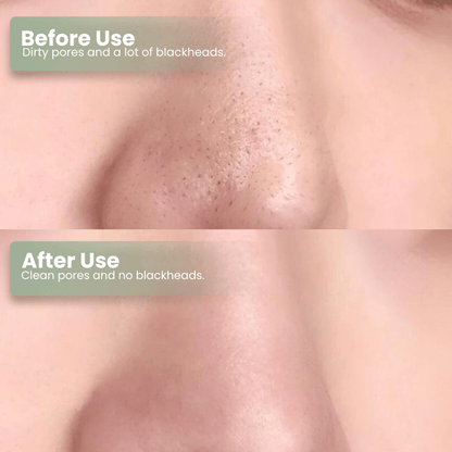 LUHAKA®  Green Tea Deep Cleanse Mask Stick ACE