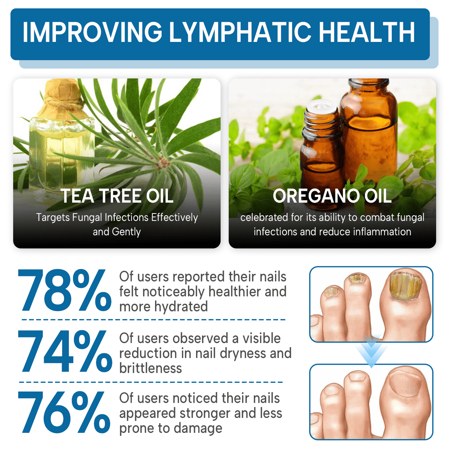 Lyyeto® OnyxiGuard Fungal Repair Herbal Spray ACE