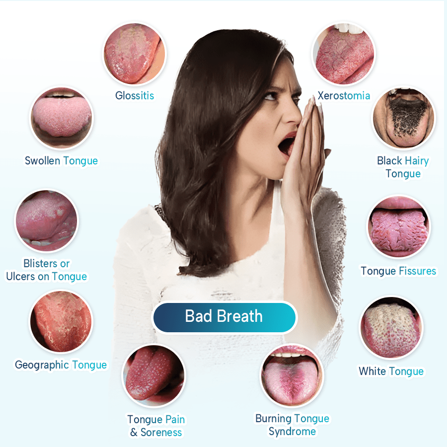 Lyyeto® GlosShield Tongue Repair Spray