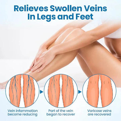 Lyyeto® VeinGuard Herbal Spray-✅ Clinically proven to eliminate varicose veins in just 7 days!