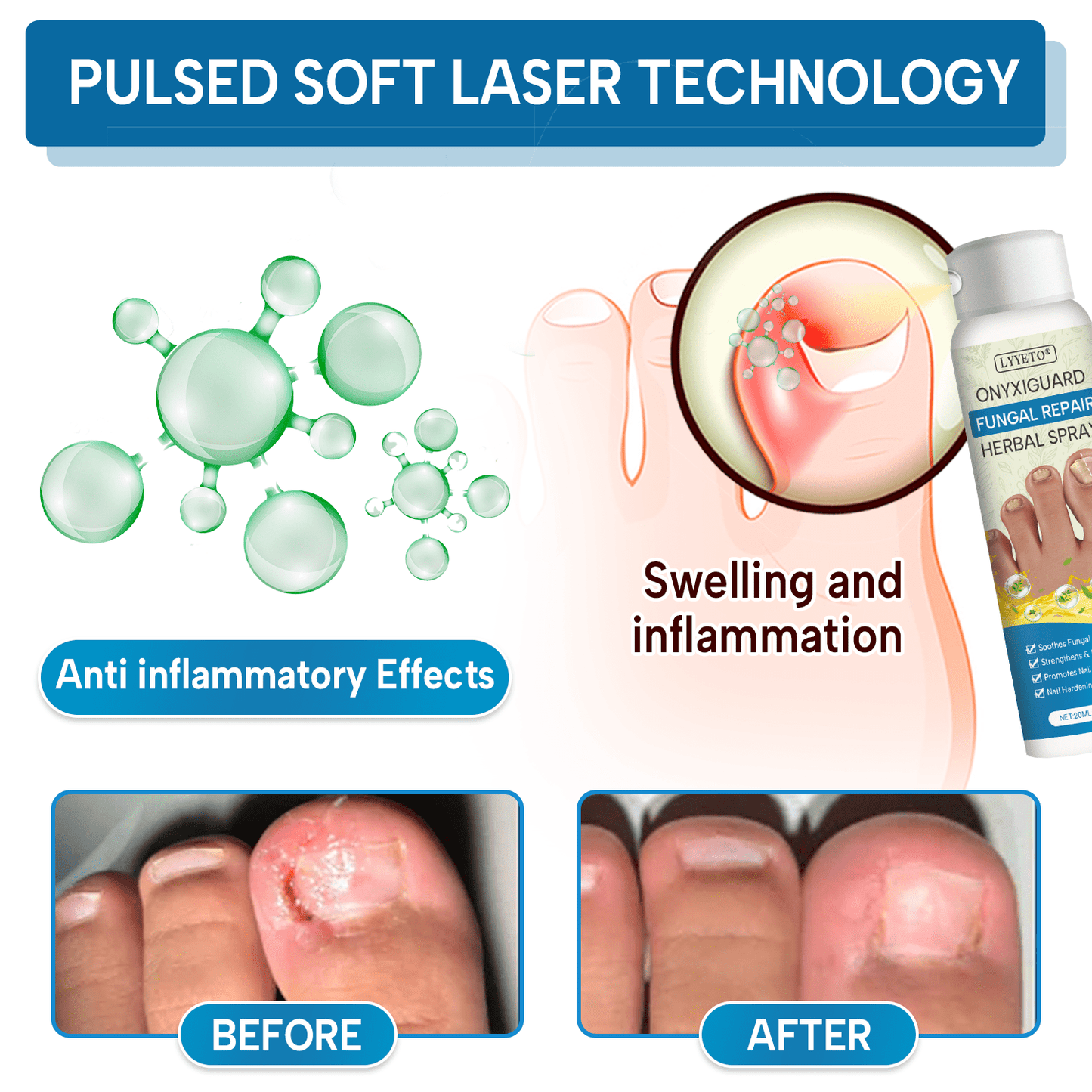 Lyyeto® OnyxiGuard Fungal Repair Herbal Spray ACE