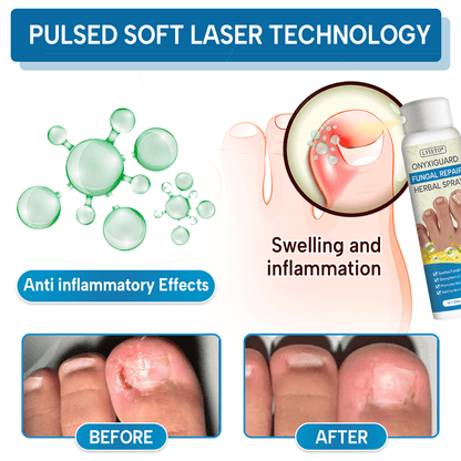 Lyyeto® OnyxiGuard Fungal Repair Herbal Spray ACE