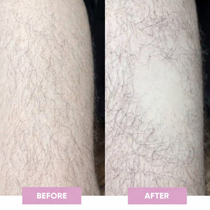 ✨50% OFF NOW! Palm‑Fit Hair Eraser for Quick At‑Home Grooming. Painless Crystal Hair Remover. Eco‑Friendly Reusable Physical Hair Removal Tool for Legs. Arms & Body