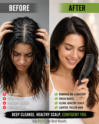 Scalp Cleansing Comb