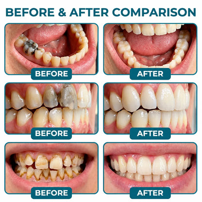 BalanceVie EnamelArc Targeted Enamel Care Gel