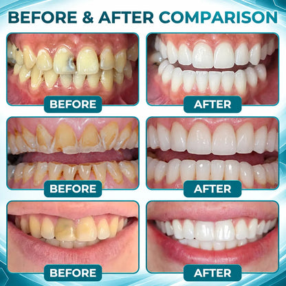 BalanceVie EnamelArc Targeted Enamel Care Gel