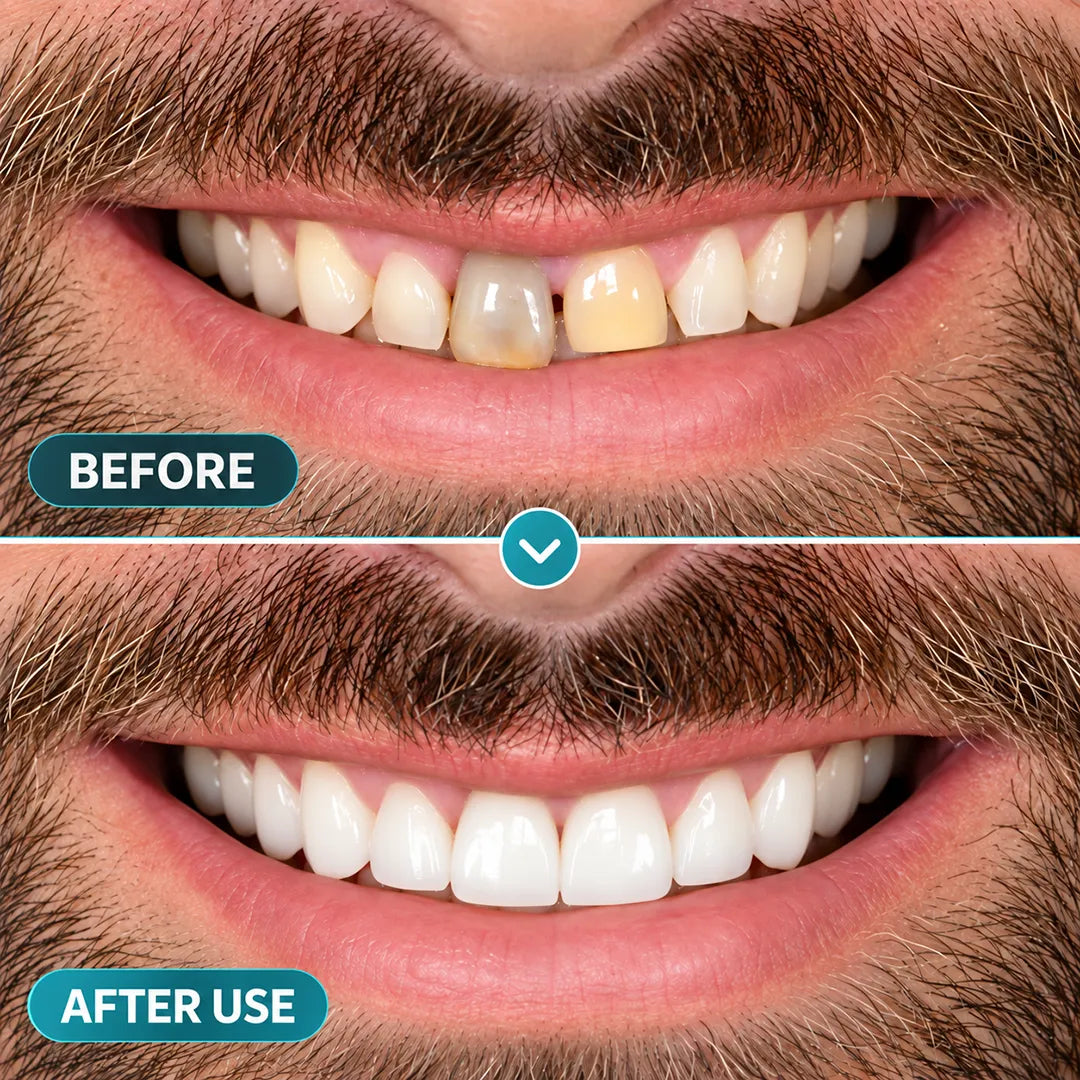 BalanceVie EnamelArc Targeted Enamel Care Gel