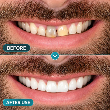 BalanceVie EnamelArc Targeted Enamel Care Gel