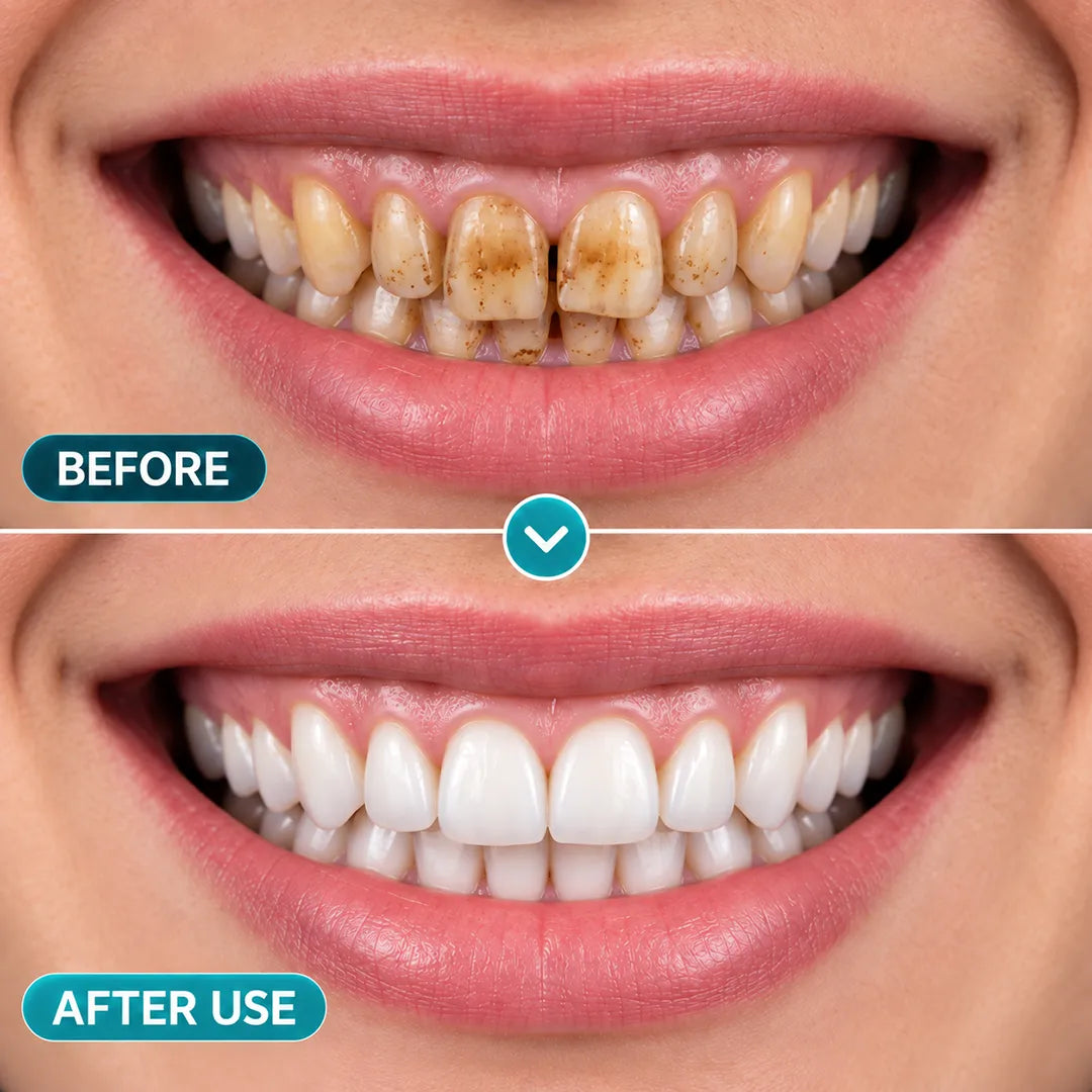 BalanceVie EnamelArc Targeted Enamel Care Gel